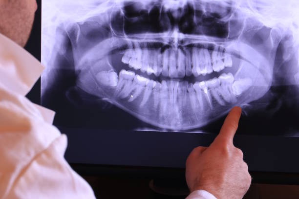 Best Emergency Root Canal Treatment in Maple Bluff, WI
